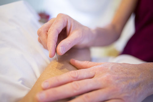 Advertise your Acupuncture services tto your service area patients.